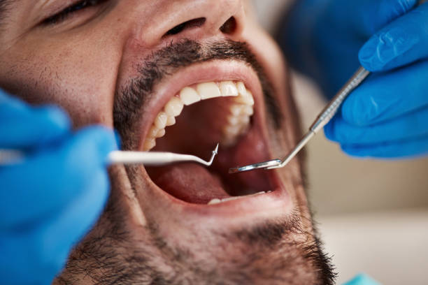 Best Emergency Treatment for Oral Infections in Grantsburg, WI