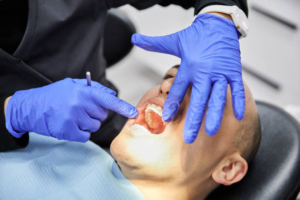 Best Knocked-Out Tooth (Avulsed Tooth) Treatment in Grantsburg, WI